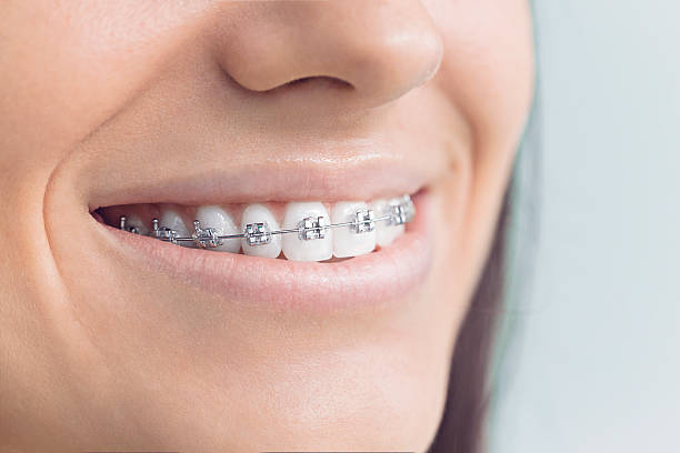 Best Traditional Braces  in Maury, NC